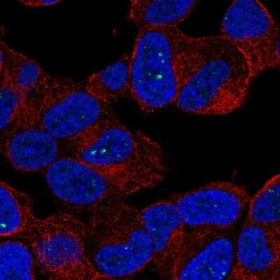 Immunocytochemistry/ Immunofluorescence: FATP6/SLC27A6 Antibody [NBP3-05511]