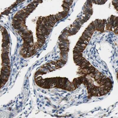 Immunohistochemistry-Paraffin: FATP6/SLC27A6 Antibody [NBP3-05511]