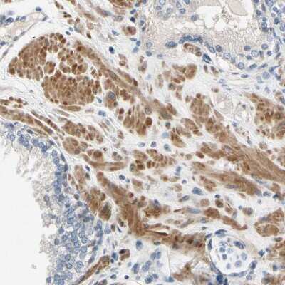 Immunohistochemistry-Paraffin: FATP6/SLC27A6 Antibody [NBP3-05511]
