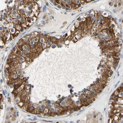 Immunohistochemistry-Paraffin: FATP6/SLC27A6 Antibody [NBP3-05511]