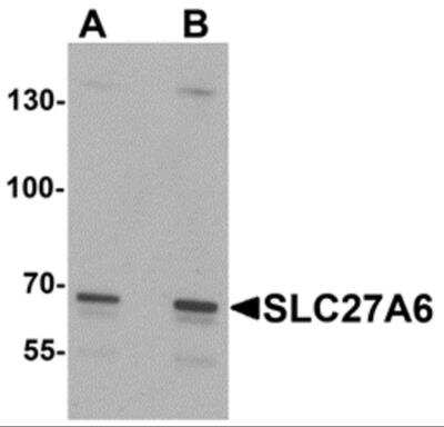 Western Blot: FATP6/SLC27A6 AntibodyBSA Free [NBP2-81909]