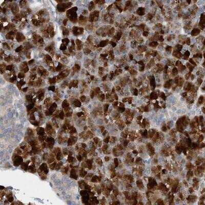 Immunohistochemistry: FBF1 Antibody [NBP1-90863]