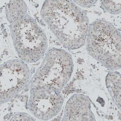 Immunohistochemistry-Paraffin: FBF1 Antibody [NBP1-90863]