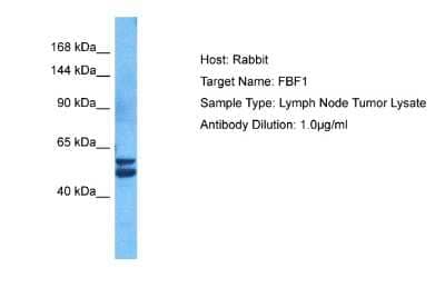 Western Blot: FBF1 Antibody [NBP2-82742]