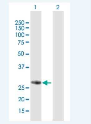 Western Blot: FBG4 Antibody [H00115290-B01P-50ug]