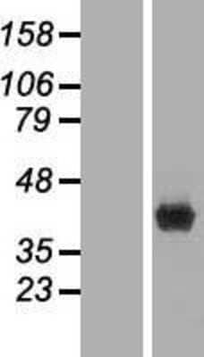 Western Blot: FBPase 1 Overexpression Lysate [NBL1-10611]