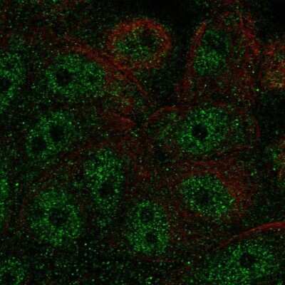 Immunocytochemistry/ Immunofluorescence: FBP2 Antibody [NBP2-58520]