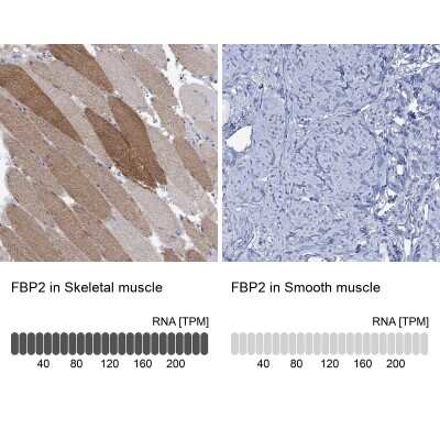 Immunohistochemistry-Paraffin: FBP2 Antibody [NBP3-17033]