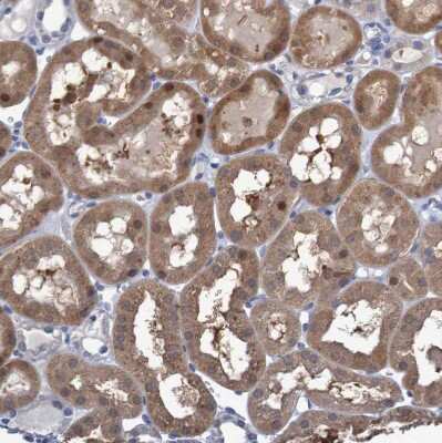 Immunohistochemistry-Paraffin: FBP2 Antibody [NBP1-86473]