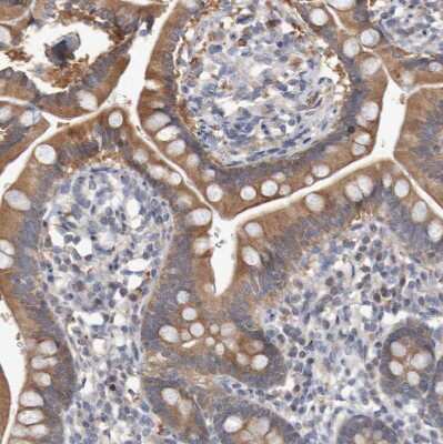 Immunohistochemistry-Paraffin: FBP2 Antibody [NBP1-86473]