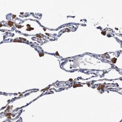 Immunohistochemistry-Paraffin: FBP2 Antibody [NBP1-86473]