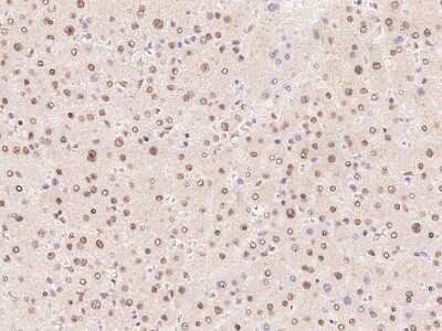 Immunohistochemistry-Paraffin: FBP2 Antibody [NBP2-97862]