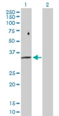Western Blot: FBP2 Antibody [H00008789-D01P]