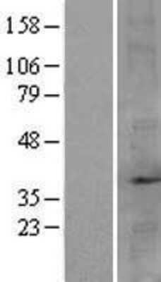 Western Blot: FBP2 Overexpression Lysate [NBP2-07944]