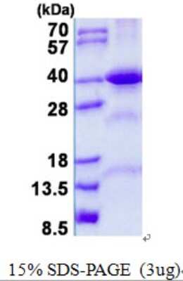 SDS-PAGE: Recombinant Human FBP2 His Protein [NBP2-23061]