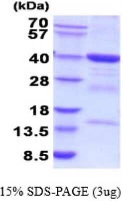 SDS-PAGE: Recombinant Human FBP2 His Protein [NBP2-52235]