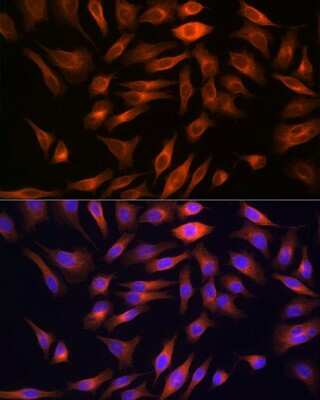 Immunocytochemistry/ Immunofluorescence: FBPase 1 Antibody (7N8C1) [NBP3-15423]
