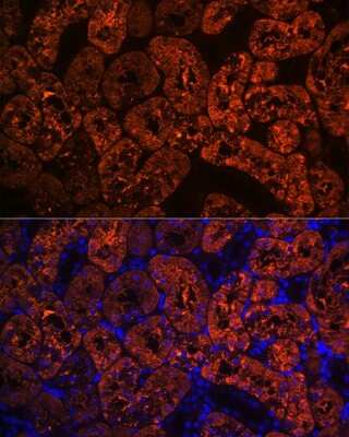 Immunohistochemistry: FBPase 1 Antibody (7N8C1) [NBP3-15423]