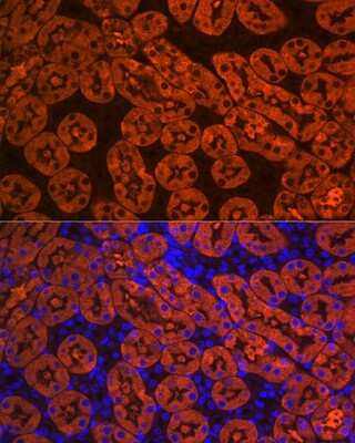 Immunohistochemistry: FBPase 1 Antibody (7N8C1) [NBP3-15423]