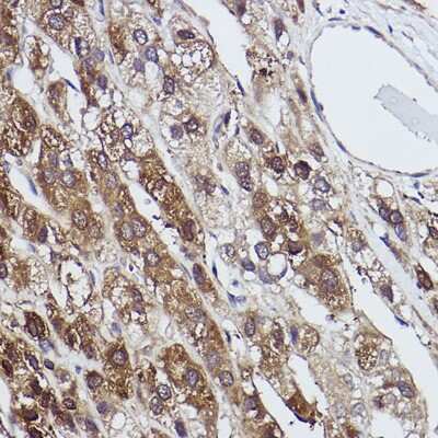Immunohistochemistry-Paraffin: FBPase 1 Antibody (7N8C1) [NBP3-15423]
