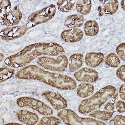 Immunohistochemistry-Paraffin: FBPase 1 Antibody (7N8C1) [NBP3-15423]
