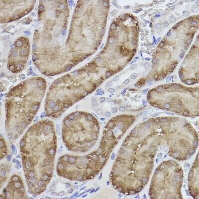 Immunohistochemistry-Paraffin: FBPase 1 Antibody (7N8C1) [NBP3-15423]