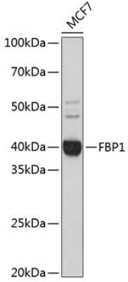 Western Blot: FBPase 1 Antibody (7N8C1) [NBP3-15423]