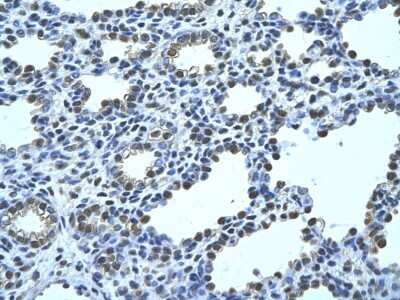Immunohistochemistry: FBPase 1 Antibody [NBP1-55293]