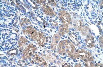 Immunohistochemistry-Paraffin: FBPase 1 Antibody [NBP1-55293]