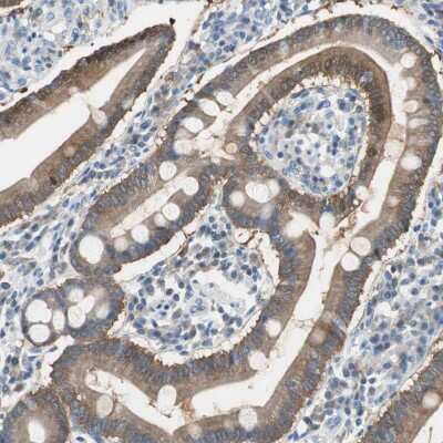 Immunohistochemistry-Paraffin: FBPase 1 Antibody [NBP1-84721]
