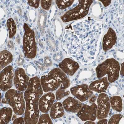Immunohistochemistry-Paraffin: FBPase 1 Antibody [NBP1-84721]