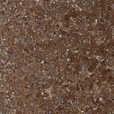 Immunohistochemistry-Paraffin: FBPase 1 Antibody [NBP1-84721]