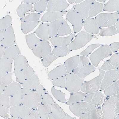 Immunohistochemistry-Paraffin: FBPase 1 Antibody [NBP1-84721]