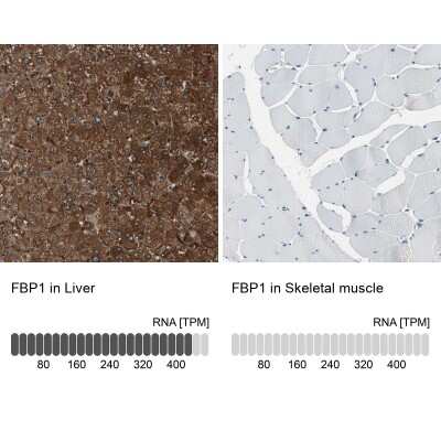 Immunohistochemistry-Paraffin: FBPase 1 Antibody [NBP1-84721]