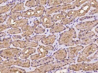 Immunohistochemistry-Paraffin: FBPase 1 Antibody [NBP2-97978]