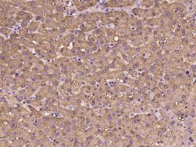 Immunohistochemistry-Paraffin: FBPase 1 Antibody [NBP2-97978]