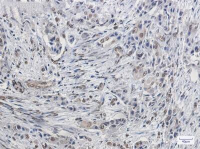 Immunohistochemistry-Paraffin: FBPase 1 Antibody (S04-1D6) [NBP3-19953]