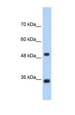 Western Blot: FBPase 1 Antibody [NBP1-55293]