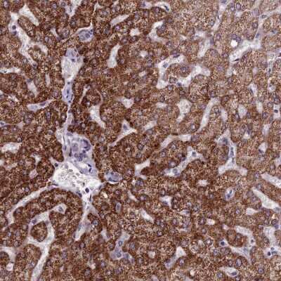 Immunohistochemistry-Paraffin: FBRS Antibody [NBP1-83917]