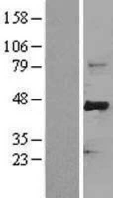 Western Blot: FBXW7/Cdc4 Overexpression Lysate [NBL1-10647]