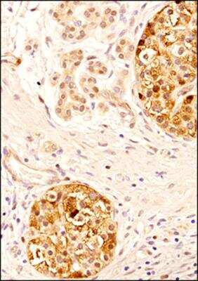 Immunohistochemistry-Paraffin: FBX09 Antibody [NBP2-27364]