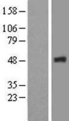 Western Blot: FBX09 Overexpression Lysate [NBL1-10643]