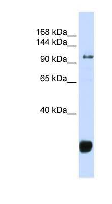 Western Blot: FBX10 Antibody [NBP1-79559]