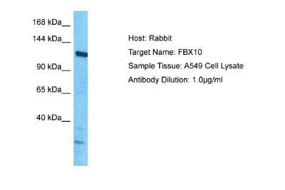 Western Blot: FBX10 Antibody [NBP2-84928]