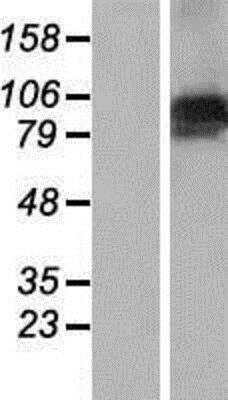 Western Blot: FBX10 Overexpression Lysate [NBP2-10363]