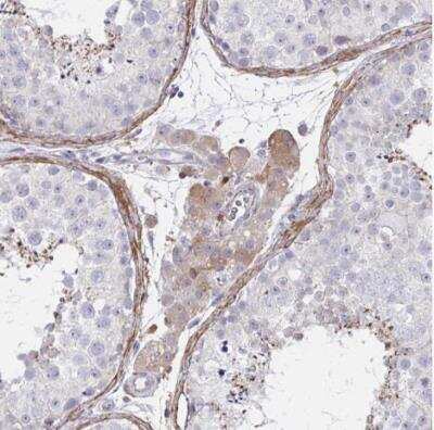 Immunohistochemistry-Paraffin: FBXL13 Antibody [NBP2-31664]