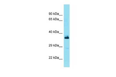 Western Blot: FBXL15 Antibody [NBP3-09719]