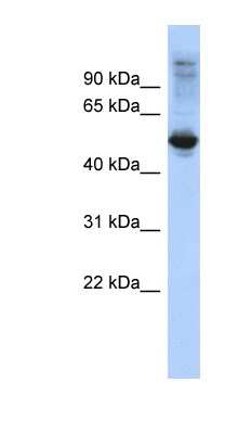 Western Blot: FBXL16 Antibody [NBP1-57613]