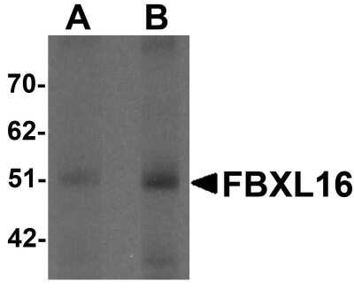 Western Blot: FBXL16 AntibodyBSA Free [NBP1-76527]