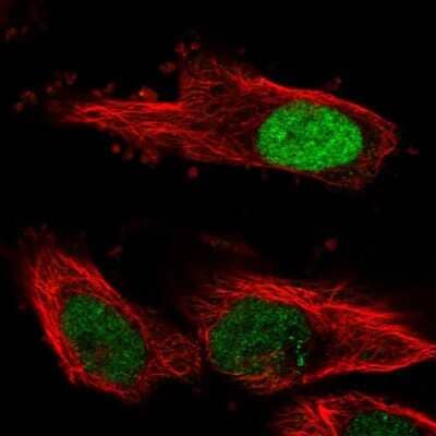 Immunocytochemistry/ Immunofluorescence: FBXL17 Antibody [NBP2-32663]